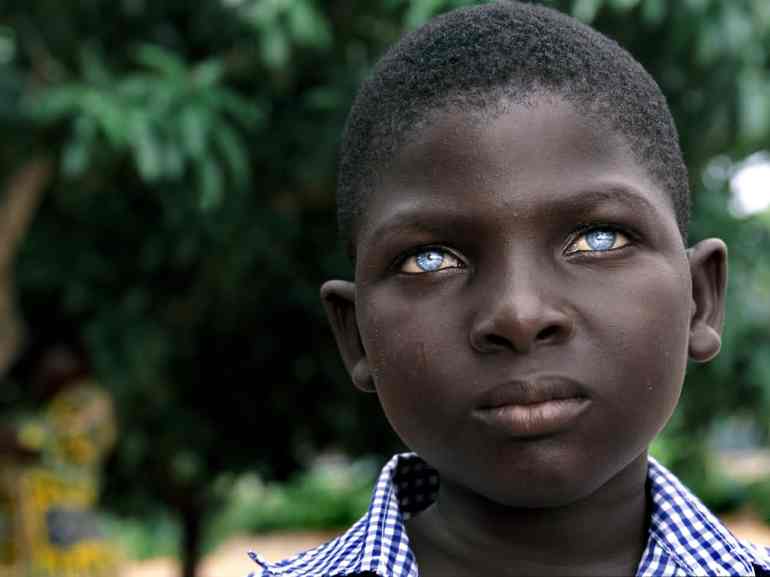 Brenam Brenam Gatien Kebalou is deaf but he is lucky. Rather than abandonning him, his single mother struggles to keep him enrolled in one of four deaf schools in Togo, West Africa. The stigma of a handicap leads many families to abandon their 'different' children, only to become mute beggars on the busy streets of large cities.